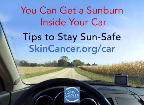 Can You Sunburn Through Car Glass Can You Sunburn Through Car Glass